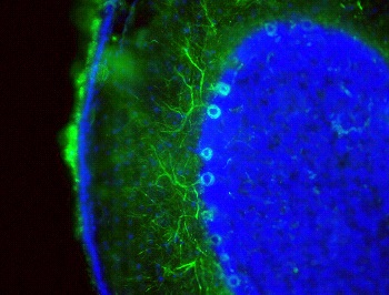 Cerebellum 20x combined adjusted brightened